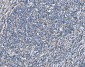 Anti-SOD2 Antibody Picoband™ (monoclonal, 2B12B1)